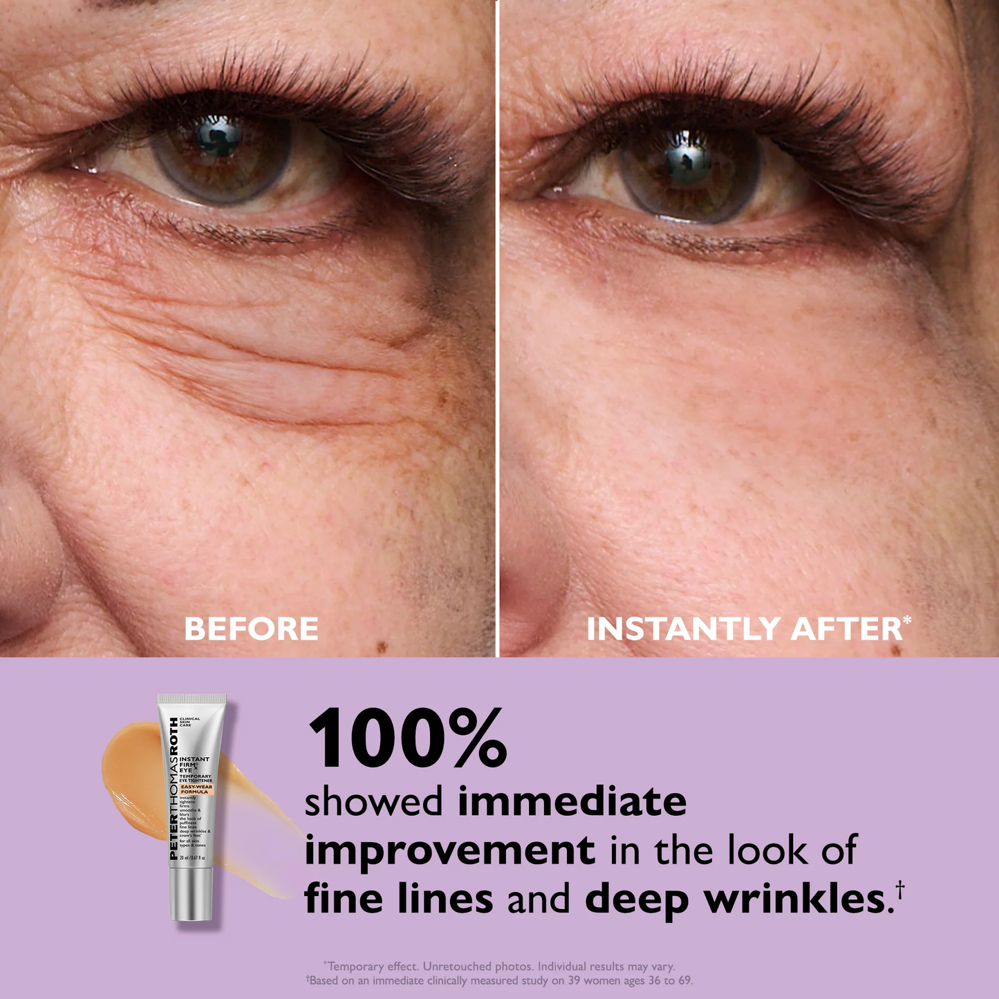 ByeBags™ Temporary Eye Tightener