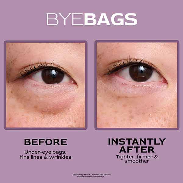 ByeBags™ Temporary Eye Tightener