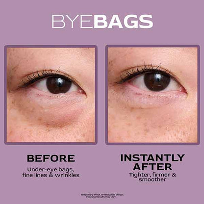 ByeBags™ Temporary Eye Tightener